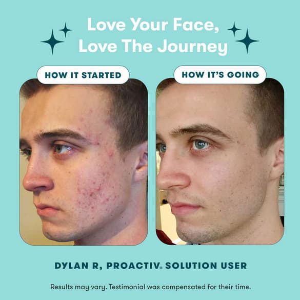 Proactiv Results: Before and After Pictures of Clear Skin.