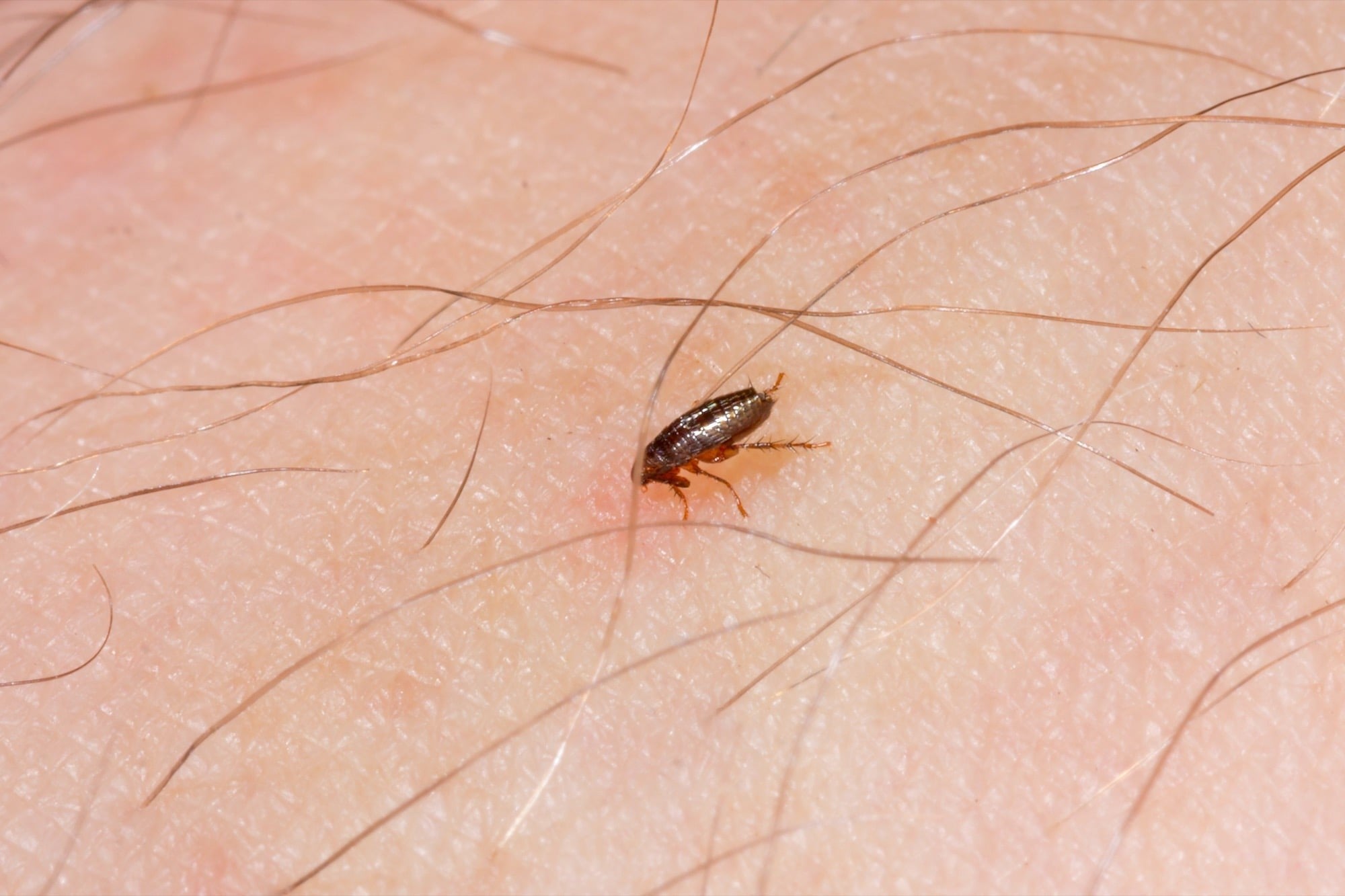 Can fleas survive the dryer cycle? Simple tips for using your dryer to get rid of them.