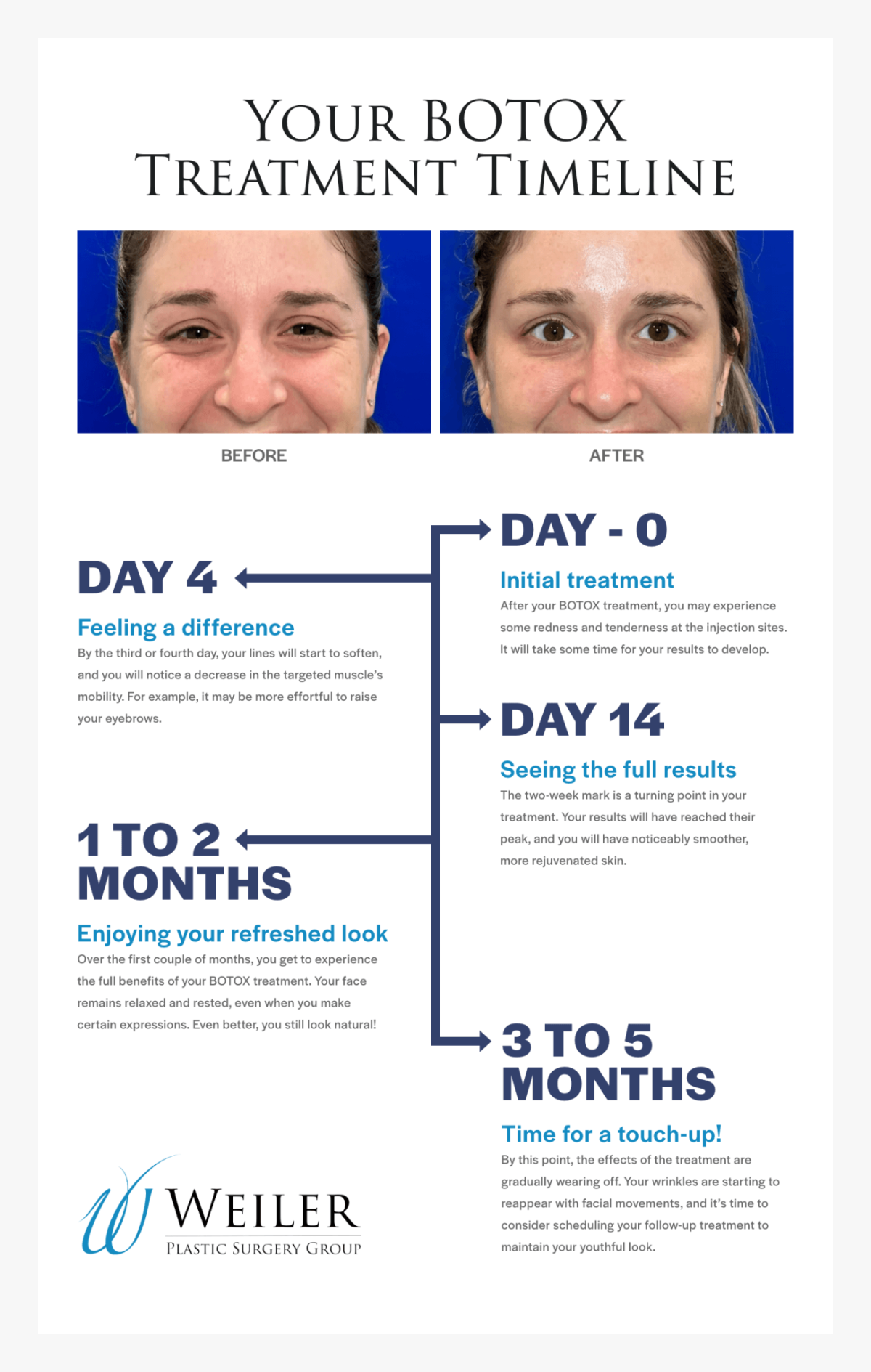 How long does Botox last? Understand these key factors that truly determine its duration.