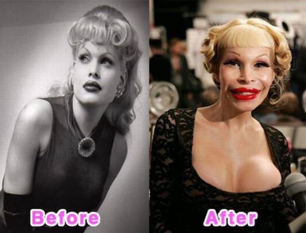 Curious about Amanda Lepore 70s transformation? Look at amazing photos of her early journey.