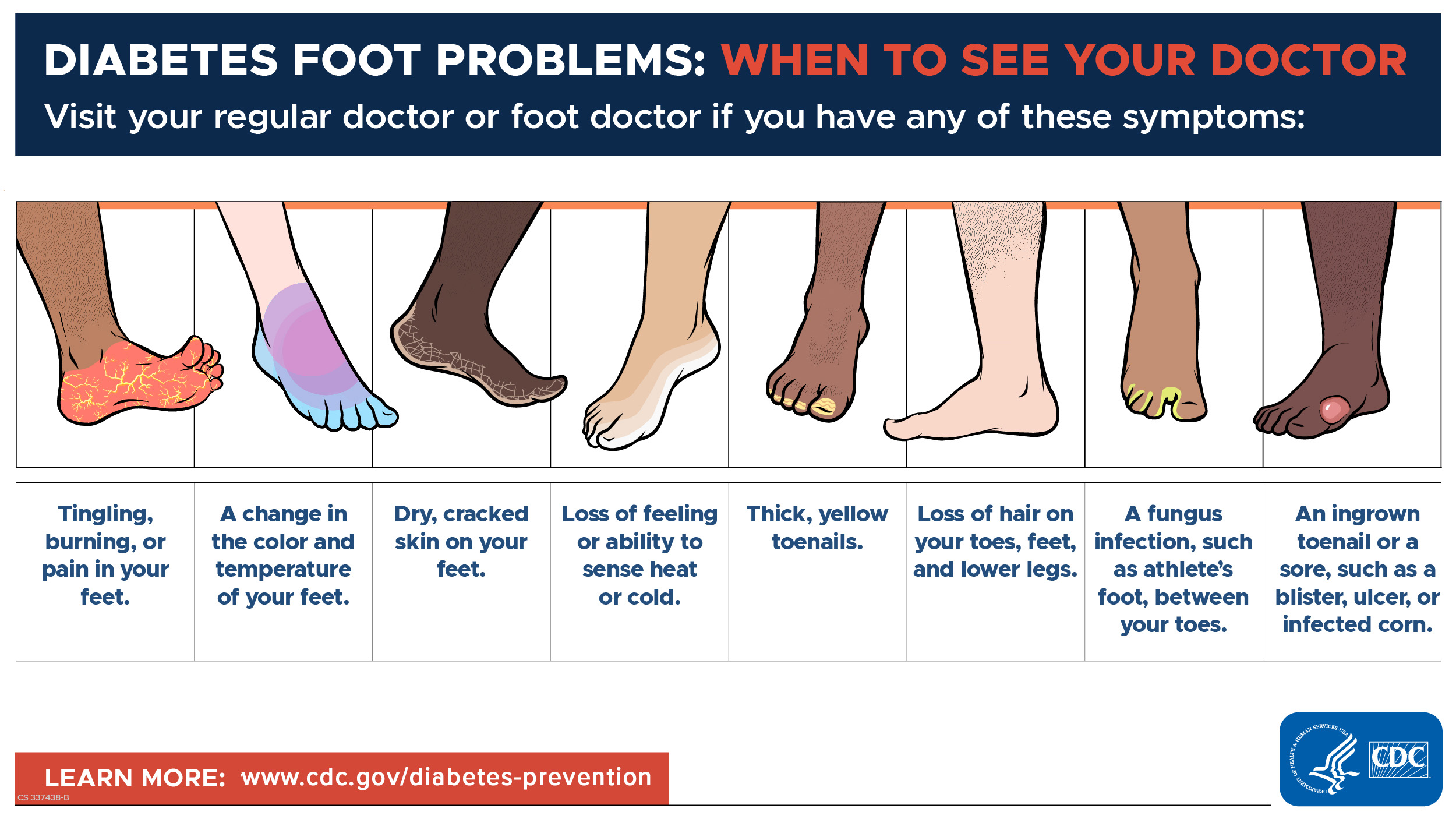Why are my feet shrinking? (Understand if its normal or if you should talk to your doctor soon)