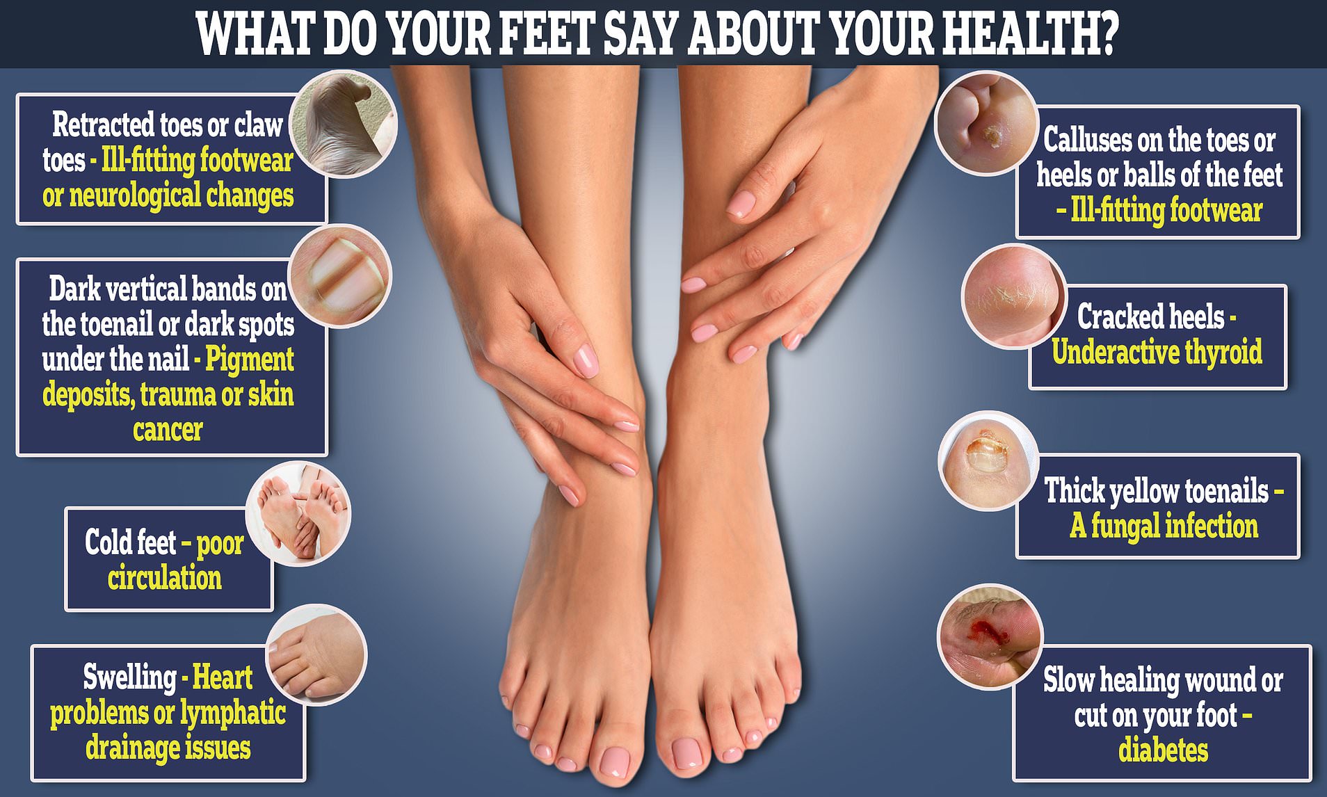 Why are my feet shrinking? (Understand if its normal or if you should talk to your doctor soon)
