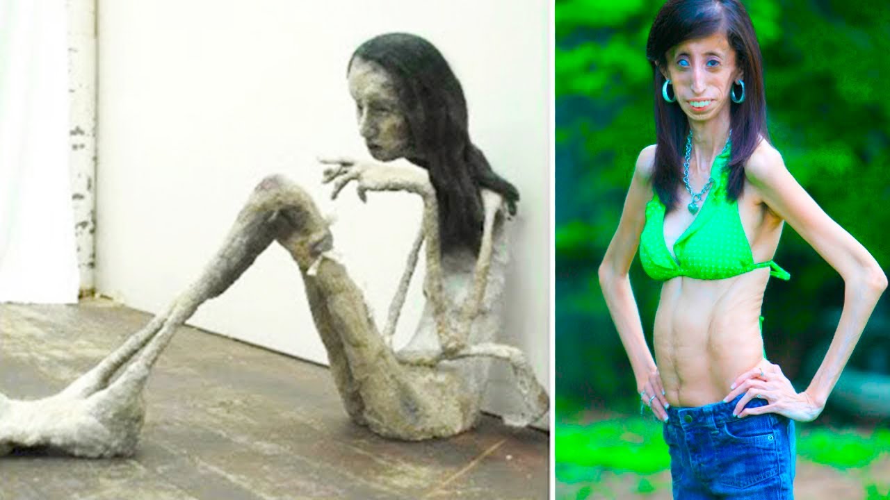 Is there a real thinnest guy in the world record? (Get the true facts about this title)