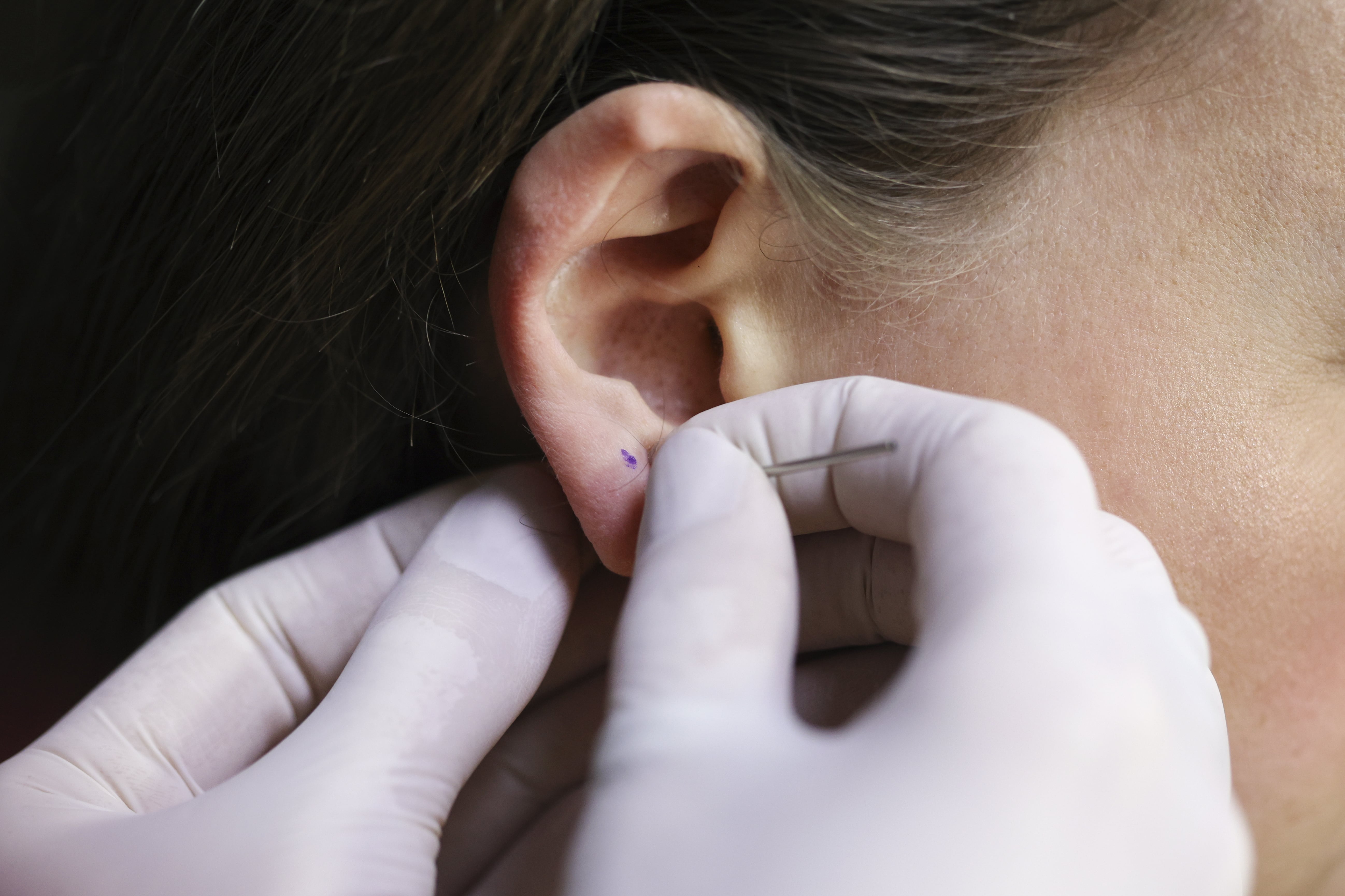 Does repiercing ears hurt more than the first time? (Get tips to reduce the pain now)