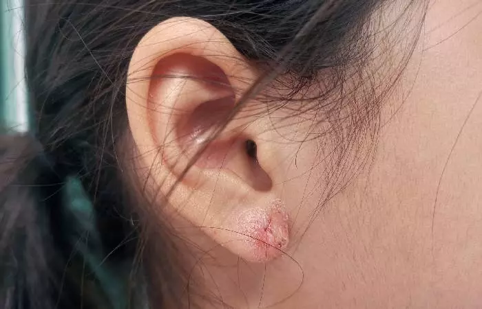 What should you know before repiercing ears? Get these key facts for a successful result!