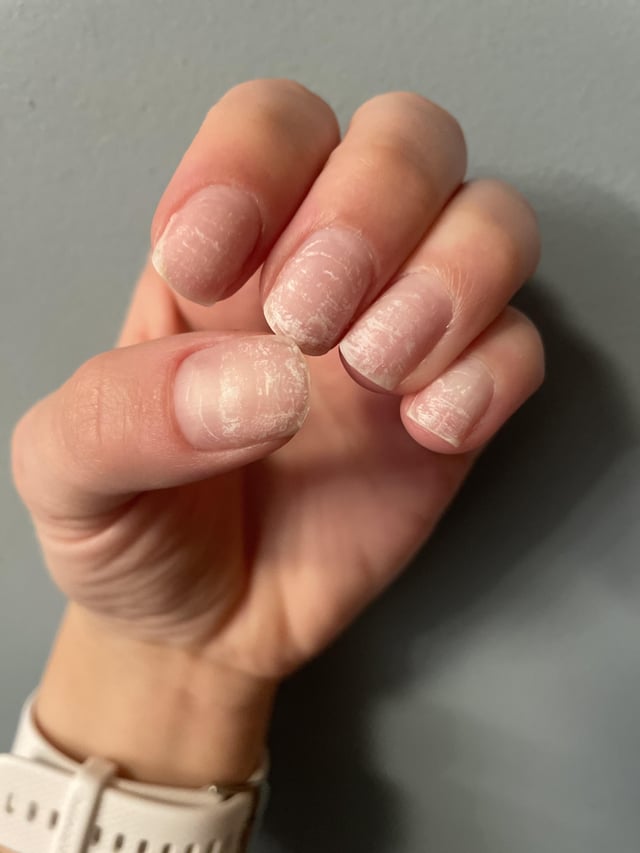 Gel or Dip Powder: Which Causes Less Nail Damage