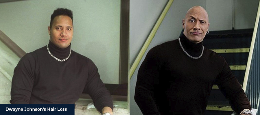 Dwayne Johnson Hair Change: See His Best Hairstyles Over Years