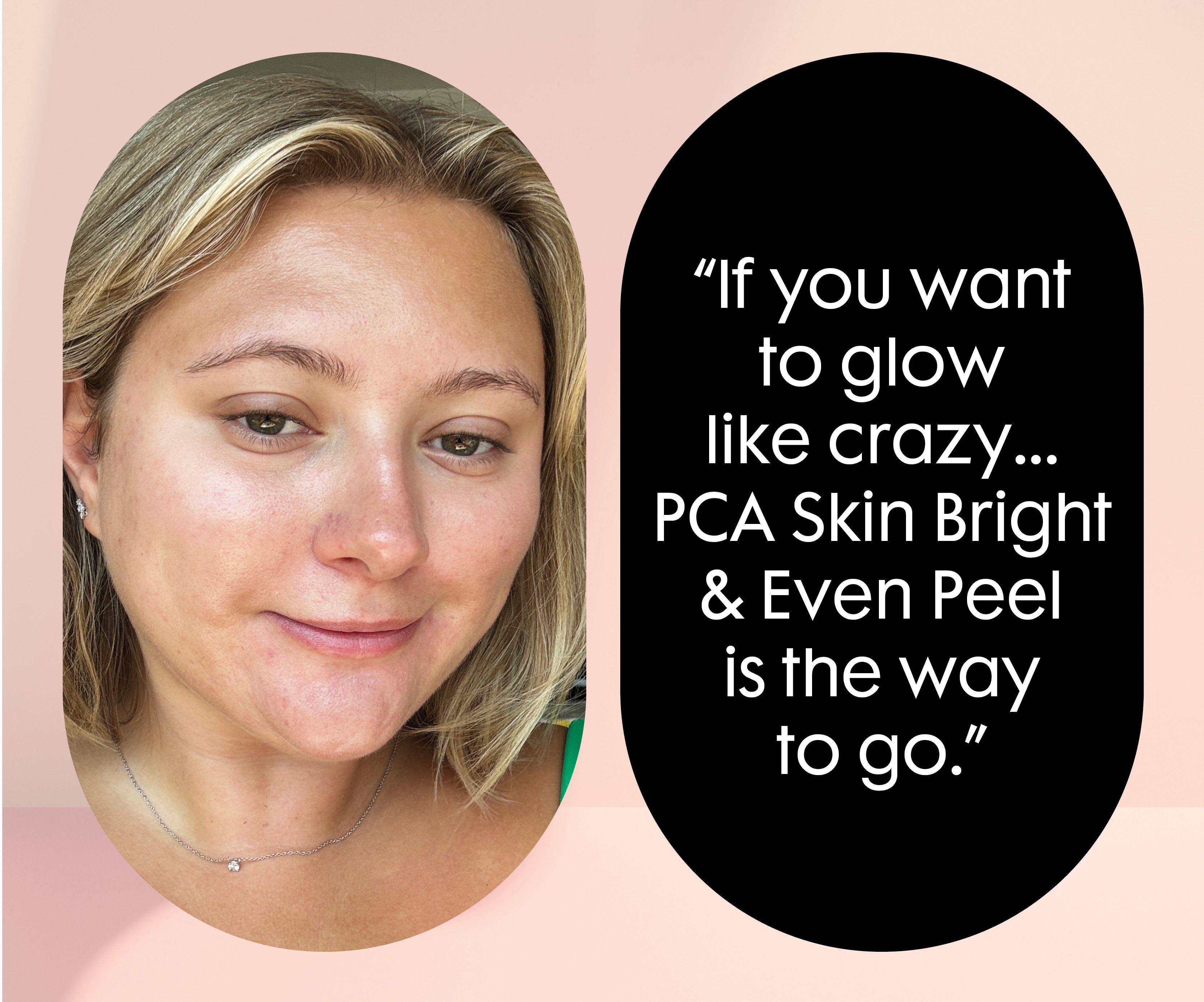 PCA Facial Cost Saving Tips (Get Glow Without Breaking Bank)